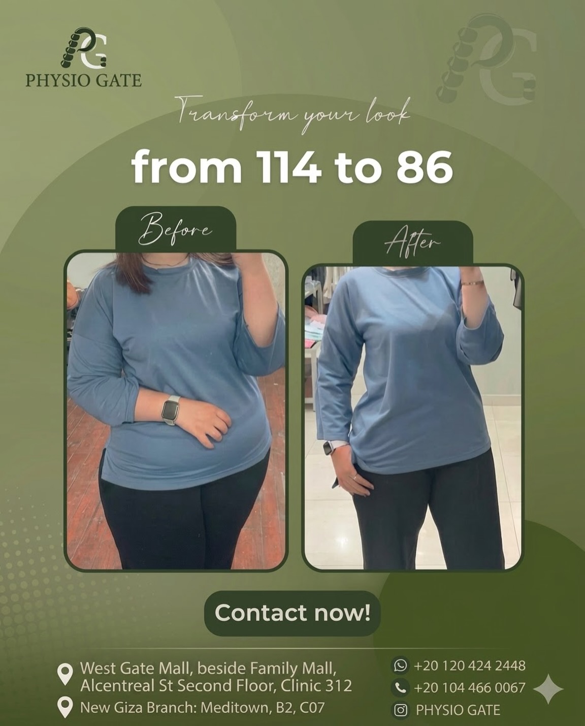Nutrition and reshaping case, before and after